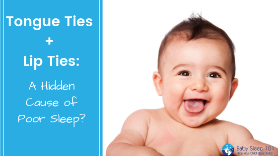 tongue ties; do they cause your baby to not sleep?